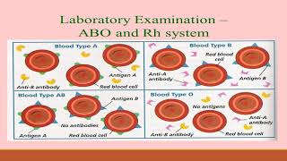 Blood group systems and its Medico  Legal importance 1