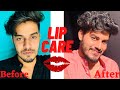 ചുണ്ടിന്റെ നിറം മെച്ചപ്പെടുത്താം💋💋|Dark lips to Bright red lips | Lipcare malayalam |Men selfcare