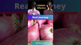 onion juice for hair growth Hair Regrowth Transformation Real Results Onion Hair #shorts #ytshorts