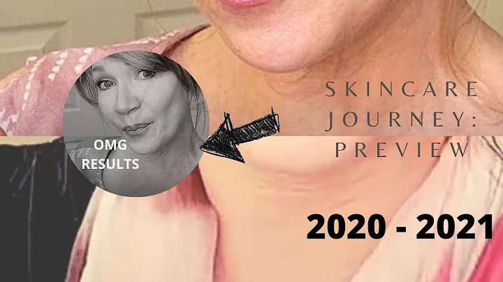 Anti-Aging Skincare Journey: 2020 2021 - Look at these results!