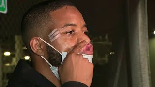 Criminal charges expected Monday against Miami Beach officers after rough arrests