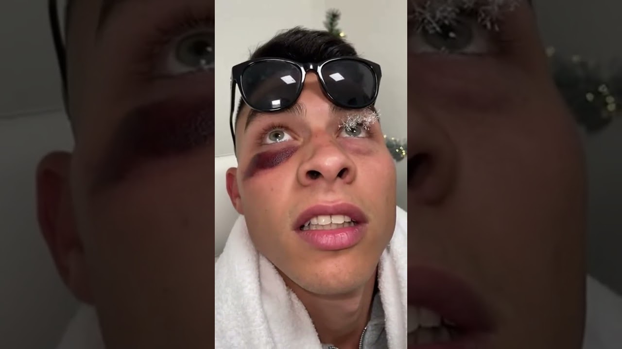 When your dermatologist is a monkey! 😂🦧 