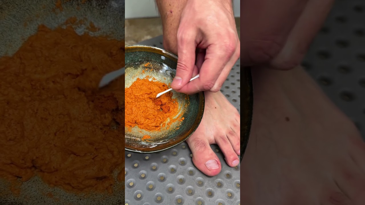 Засыпаю красный перец в соду это альтернатива дорогим мазям￼ 