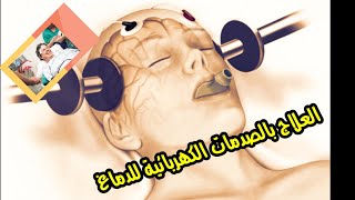 العلاج بالصدمات الكهربائية ECT