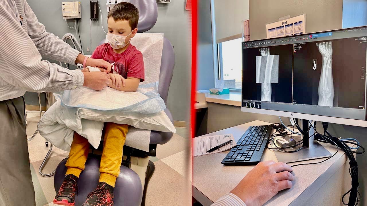 КОДИ получает НАСТОЯЩИЙ ПРИЗ/Сломанная рука