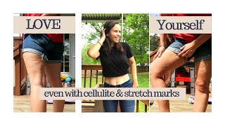 Cellulite and Stretch Mark Chat- How to be comfortable in your skin