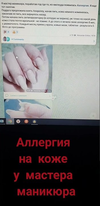 Как избавиться от аллергии на коже? Шелушение кожи у мастера маникюра ...