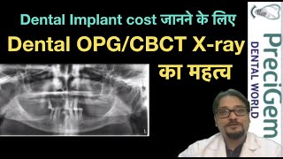 Cost dental implants | Dental OPG & CBCT X-ray का महत्व | best dentist in mumbai | Dr Mayur Khairnar screenshot 5