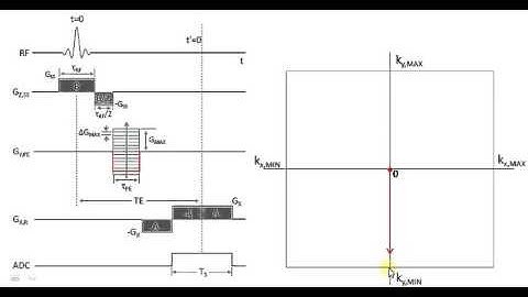 Magnetic Resonance Imaging Basics Course: "K-Space" Traversal in a Gradient-Echo Pulse Sequence