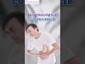 Deadly Signs of Colon Cancer #coloncancer #cancertreatment