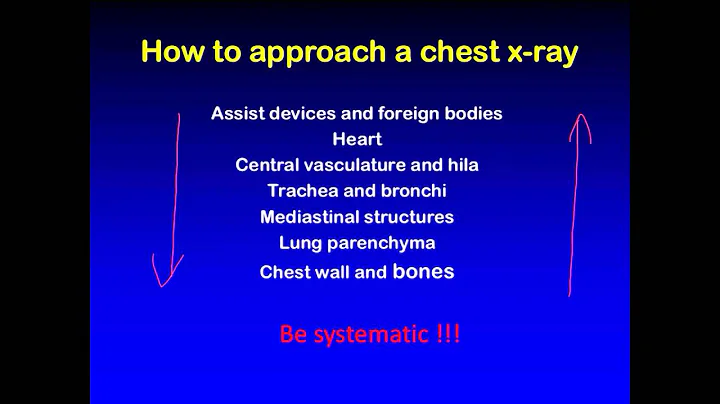 Reading a Chest X-ray