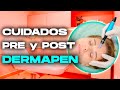 DERMAPEN ✅ Que CUIDADOS debo realizar ANTES y DESPUÉS ?  CURSO ONLINE 🏅 Cap. 4