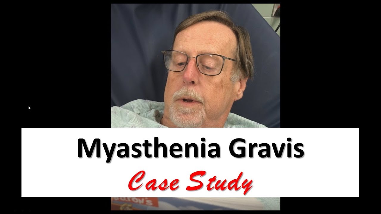 case study 66 myasthenia gravis