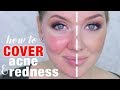 How to Cover Acne & Redness | DRUGSTORE Makeup