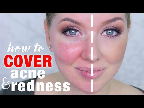 How to Cover Acne & Redness | DRUGSTORE Makeup