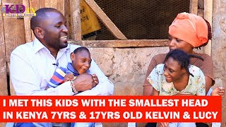 MEET KELVIN AND LUCY WITH SMALLEST HEADS IN THE WORLD UNCOMMON CONDITION IN KENYA