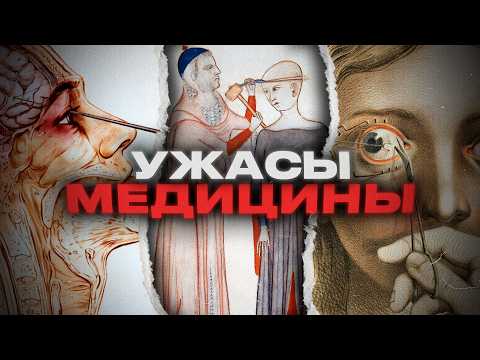 АЙСБЕРГ УЖАСОВ МЕДИЦИНЫ [ч.1]
