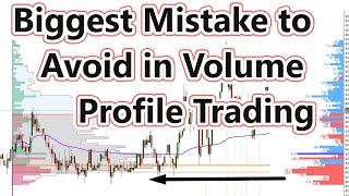 Biggest Mistake to Avoid in Volume Profile Trading  Avoid This!