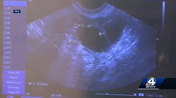 Rep Neal Collins Reax to Abortion Bills in SC