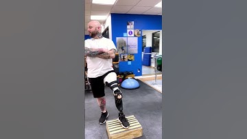 Van Nes Rotationplasty Patients Find True Mobility with the Proper Fit at A Step Ahead Prosthetics