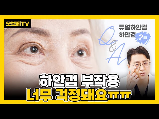 하안검에 대한 궁금증을 모두 총집합! Q&A 2탄 | 오브제성형외과 | 김현조 원장