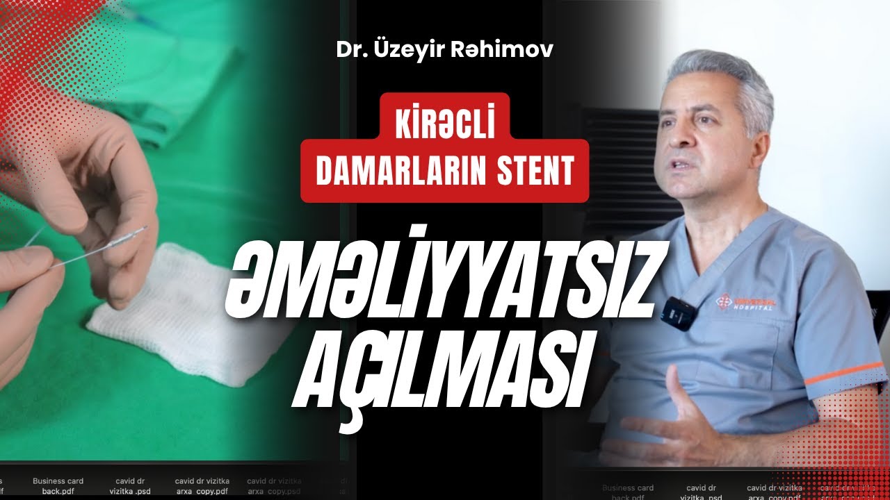Kirəcli damarların stent və ƏMƏLİYYATSIZ açılması ⚠️