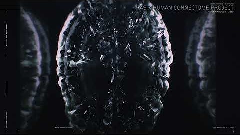 RAS x Human Connectome Project