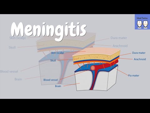 Meningitis [bacterial vs viral, symptoms, Kernig&rsquo;s sign, clinical clues, meningococcal infection]