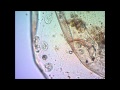 Инфузории поедают дафнию under microscope