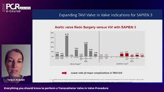 Everything you should know to perform a transcatheter valve in valve procedure - PCR Valves e-Course