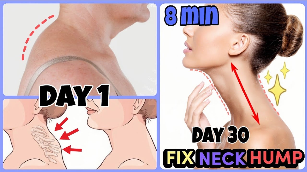 Practical tips and simple exercises to prevent neck pain