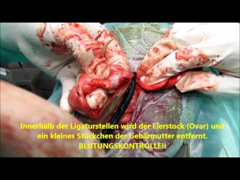 Video: Entfernung Der Gebärmutter Und Der Eierstöcke Bei Einem Hund