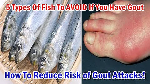 5 Types Of Fish To AVOID If You Have Gout | Reduce Risk of Gout Attacks!