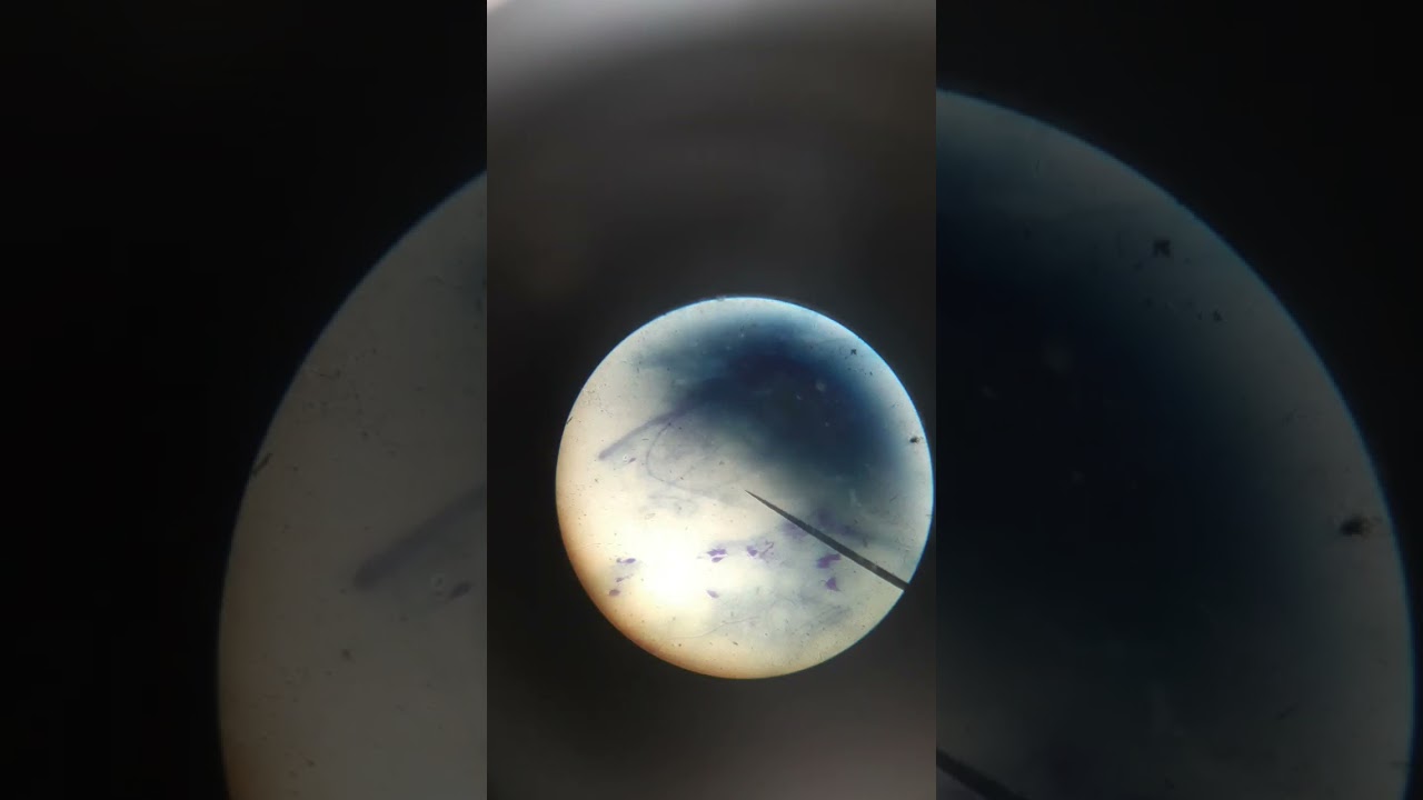 Nerve cell complete in microscope