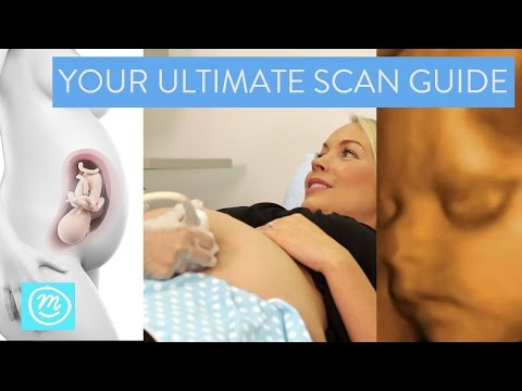 वीडियो: एक 3 डी बेबी मॉडल: परम गर्भावस्था स्कैन Memento?