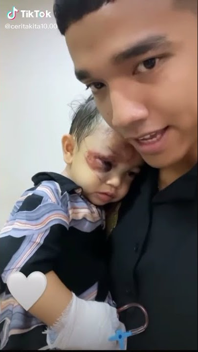 Kondisi Gala saat ini setelah mengalami kecelakaan bersama maminya Vanesa angel dan bibi