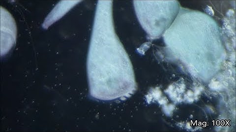 Stentor coeruleus under the Microscope