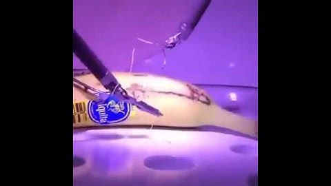 The Future of Surgery: 5G Remote Operations? #futuretech  #2050tech