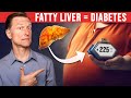 Your Fatty Liver Caused Your Diabetes