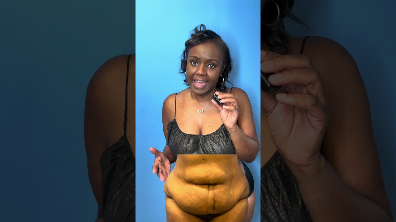 Here are the secrets to maintaining amazing Tummy Tuck results! 