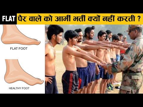 वीडियो: क्या पोस्ट की जगह गुच्छों का इस्तेमाल किया जा सकता है?