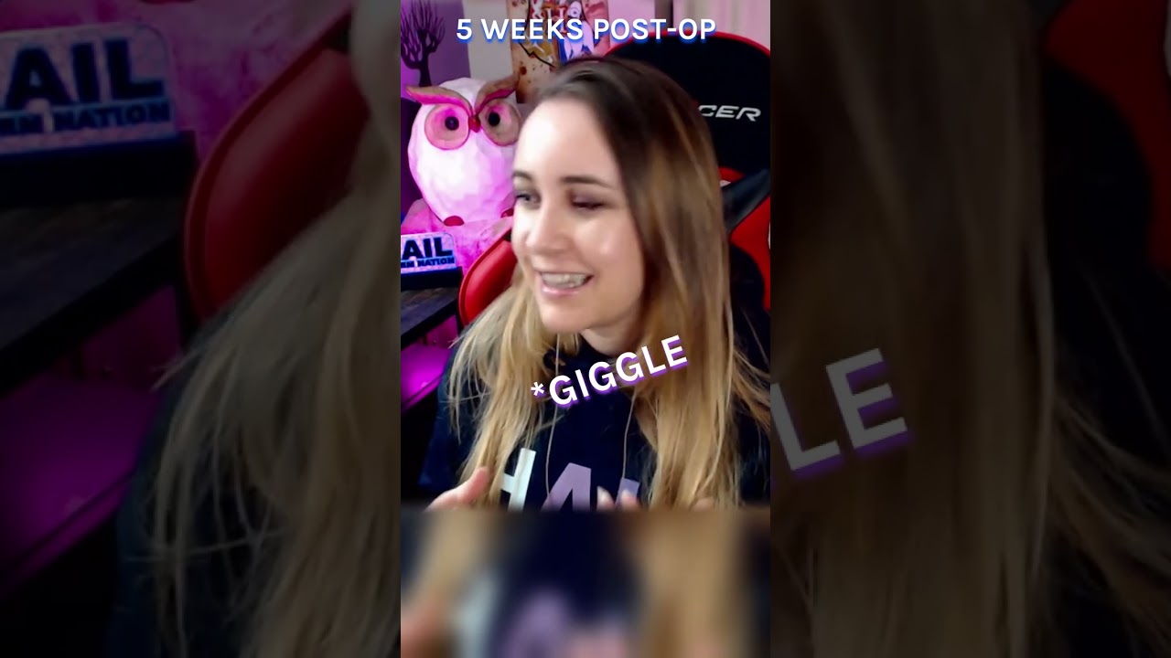 Showing off my elastics from jaw surgery 