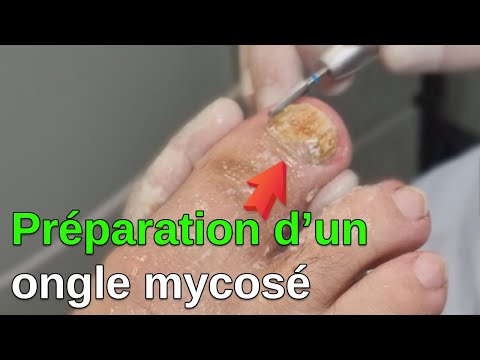 Vidéo: Donnez-vous un pourboire à un pédicure ?