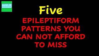 FIVE EPILEPTIFORM PATTERNS THAT YOU SHOULD NEVER MISS