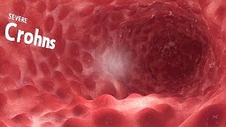 360° VR animation | inside the GI tract