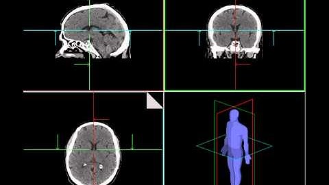 CT SCAN AXIAL VIDEO XYZ