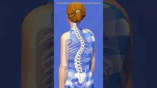 Scoliosis Correction Surgery Explained | 3D Medical Animation of Spine Alignment Procedure