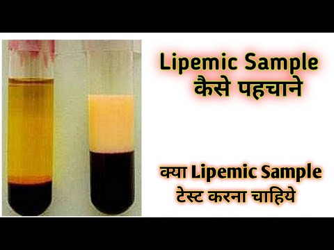Lipemic blood sample