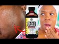 I Used BLACK SEED OIL On My Skin Everyday FOR 1O DAYS