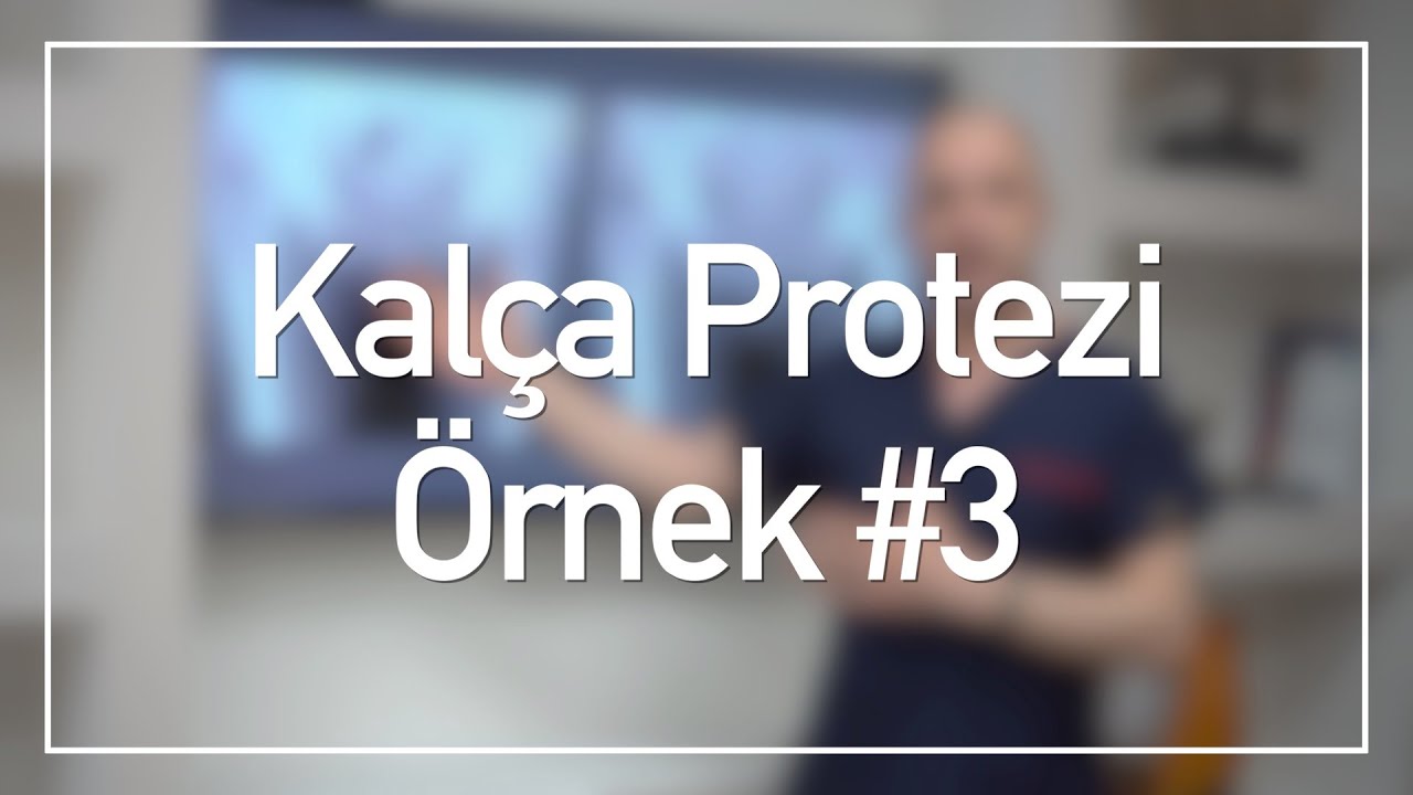 Kalça Röntgeni İnceleme | Kalça Protezi Örnekleri #3